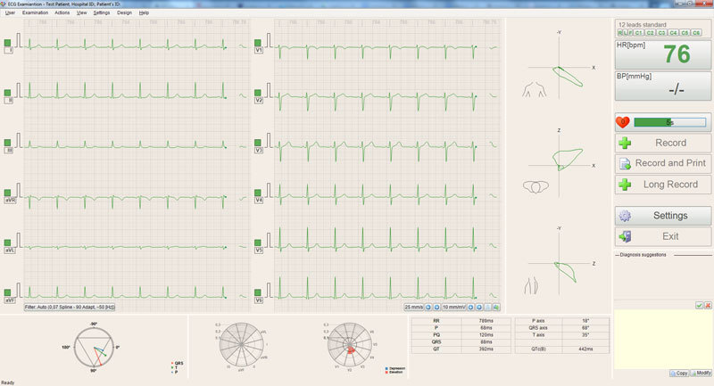 EKG prikaz 1