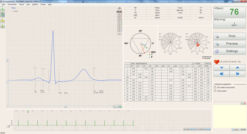 EKG prikaz 2